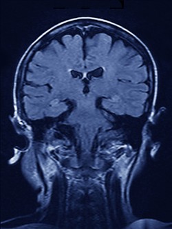 brain